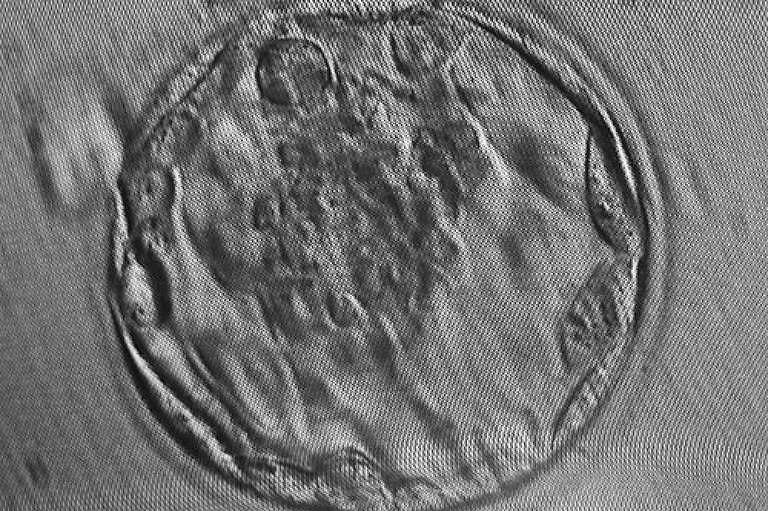 Cientistas-criam-embriões-simulados-com-poucos-dias-de-vida-em-laboratório-17032021-Ciência.jpg