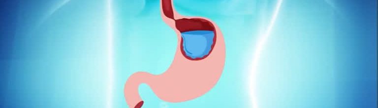 Estudo revela que brasileiros sofrem de refluxo - Minas Gerais